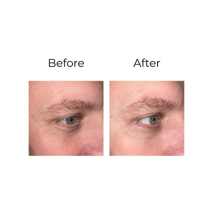 Contour des yeux anti-rides LUX001 - 20ml par Peptilux
